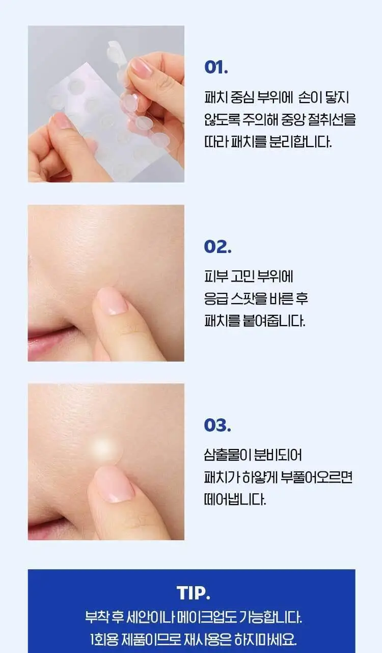 [트러블패치/기획] 아이소이 아크니 닥터 응급패치 60매&응급스팟 2ml 기획 상세페이지 11